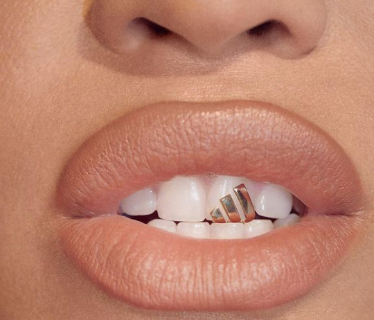 Écarteur dentaire - écarteur de bouche strass dentaire